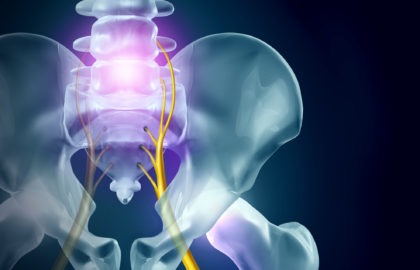 Could Sciatica Be the Cause of Your Back Pain? Here's