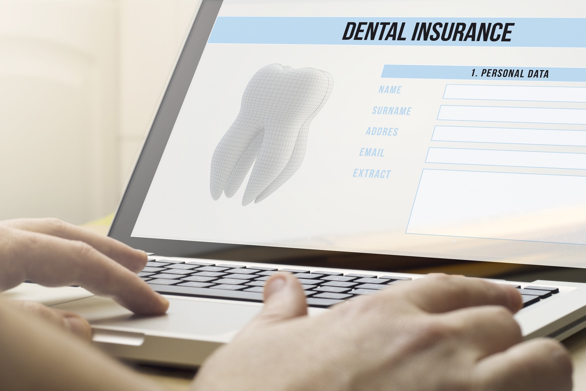 Is Dental Insurance Worth It? Here Are 8 Alternatives to
